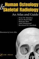 Human Osteology and Skeletal Radiology af Evan W. (University of Calgary and Academic Forensic Pathology Inc. Matshes