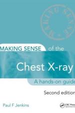 Making Sense of the Chest X-ray af Paul (Formerly Winthrop Professor of Acute Medicine at the University of Western Australia and Consultant Physician Jenkins