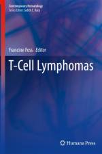 T-Cell Lymphomas