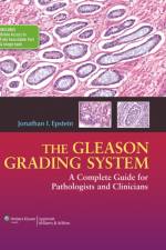The Gleason Grading System af Jonathan I. Epstein