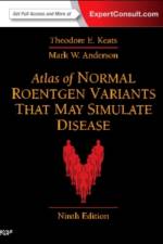 Atlas of Normal Roentgen Variants That May Simulate Disease af Theodore E. (Alumni Professor of Radiology Keats