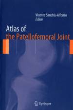 Atlas of the Patellofemoral Joint