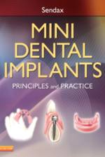 Mini Dental Implants af Victor Dr. Sendax