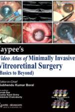 Jaypee's Video Atlas of Minimally Invasive Vitreoretinal Surgery (Basics to Beyond) af Subhendu Kumar Boral