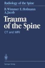 Trauma of the Spine af Berthold Wimmer