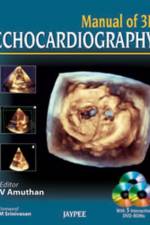 Manual of 3D Echocardiography af V Amuthan
