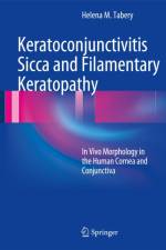 Keratoconjunctivitis Sicca and Filamentary Keratopathy af Helena M. Tabery