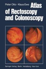 Atlas of Rectoscopy and Coloscopy af P. Otto