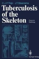 Tuberculosis of the Skeleton af Cornelis J.P. Thijn