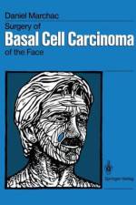 Surgery of Basal Cell Carcinoma of the Face af Daniel Marchac