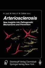 Arteriosclerosis