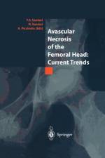 Avascular Necrosis of the Femoral Head: Current Trends