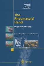 Rheumatoid Hand af L. Satragno