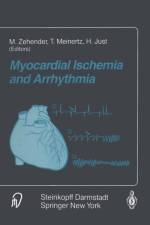 Myocardial Ischemia and Arrhythmia