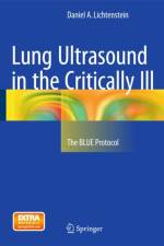 Lung Ultrasound in the Critically Ill