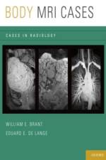 Body MRI Cases af Eduard E. (Professor of Radiology de Lange