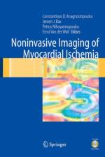 Noninvasive Imaging of Myocardial Ischemia