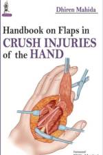 Handbook on Flaps in Crush Injuries of the Hand af Dhiren Mahida