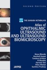 Atlas of Ophthalmic Ultrasound and Ultrasound Biomicroscopy af Muna Bhende