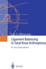 Ligament Balancing in Total Knee Arthroplasty af Leo A. Whiteside