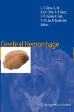 Cerebral Hemorrhage