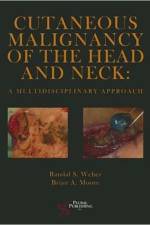 Cutaneous Malignancy of the Head and Neck af Randal S. Weber