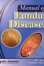Manual of Fundus Diseases af OP Ahuja