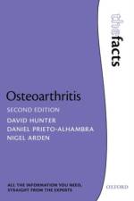 Osteoarthritis: The Facts af Daniel (Senior Clinical Research Fellow Prieto-Alhambra
