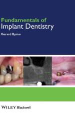 Fundamentals of Implant Dentistry af Gerard Byrne