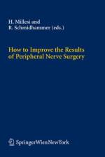 How to Improve the Results of Peripheral Nerve Surgery