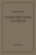 Augenarztliche Eingriffe af Josef Meller