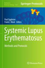 Systemic Lupus Erythematosus