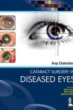 Cataract Surgery in Diseased Eyes af Arup Chakrabarti