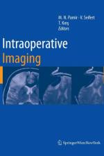 Intraoperative Imaging