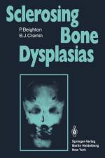 Sclerosing Bone Dysplasias af P. Beighton