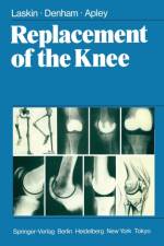 Replacement of the Knee af R.A. Denham