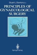 Principles of Gynaecological Surgery