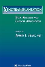 Xenotransplantation