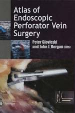 Atlas of Endoscopic Perforator Vein Surgery