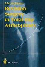 Revision Surgery in Total Hip Arthroplasty af Boguslaw M. Wroblewski