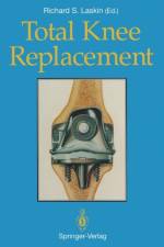 Total Knee Replacement