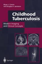 Childhood Tuberculosis: Modern Imaging and Clinical Concepts af Douglas H. Jamieson
