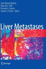 Liver Metastases