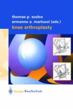 Knee Arthroplasty
