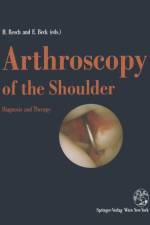 Arthroscopy of the Shoulder