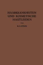 Haarkrankheiten Und Kosmetische Hautleiden af R O Stein