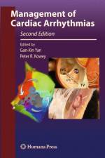 Management of Cardiac Arrhythmias