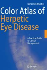 Color Atlas of Herpetic Eye Disease af Rainer Sundmacher