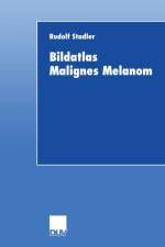 Bildatlas Malignes Melanom af Rudolf Stadler