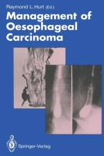 Management of Oesophageal Carcinoma